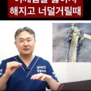 힘줄이 너덜거릴때 이미지