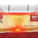 골드의료기 이미지