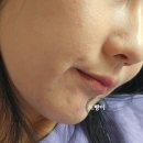 구리피부관리 장자호수공원역피부관리 뷰티안 역대급 물광필러테라피 찐만족