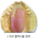 프레임치과기공소 네이버블로그