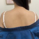 라셀 | 신사 승모근보톡스 후기 비올라셀성형외과 웨딩촬영 전 관리 내돈내산