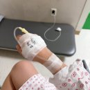 강원대학교병원 | 강원대학교병원. 강대병원 제왕절개 후기. (제왕절개 비용)