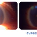 강남푸른안과의원 이미지