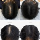 마음에 점을 찍다 이미지