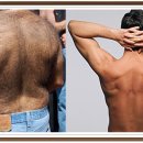 동양제모 이미지