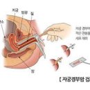 자궁경부암 검사 자궁경부암 원인 자궁경부암 주사 이미지