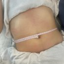 더올가 | 양산다이어트 올가드림뷰티 증산점 복부초음파 관리후기 관리후 소화도 더 잘돼