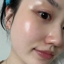 청담동 | 청담동 피부과 스킨부스터 통증 후기 가격 MTS 물광주사