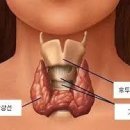 갑상선기능저하증에 좋은 음식과 피해야 할 음식 이미지