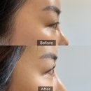 소이메디칼 | 운정속눈썹펌 잘하는곳 ㅣ운정속눈썹 소이아이뷰티랩 올블랙 마스카라 속눈썹펌 만족 후기