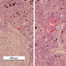 0.8% 식염수 침지에 의한 무지개송어의 Tetracapsuloides bryosalmonase감염 증식성 신장병 치료 이미지