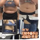 하주구내식당 | [공지] 복부지방 추출 주사 예신 다이어트 부작용 통증 붓기 솔직 후기!