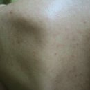 강남리유한의원 이미지