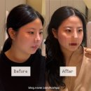 k-art 예쁜얼굴 | -구리 갈매-[약손명가 구리갈매역점] 구리 피부관리 얼굴축소 경험했어요 | K-뷰티 연예인 관리 A 후기