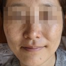 백옥 티스토리