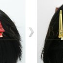 통천한의원 | 남성탈모 and 여성탈모