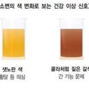 소변색깔 갈색 주황 노란색 투명의 원인 무엇인가 확인 이미지