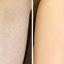 육아맘의 솔직한 유리아80000ppm 사용 경험담