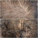 퇴계원역 | 솔직 담백! 숲칼프 남양주퇴계원역점에서 불면증 이겨낸 퇴계원탈모관리 후기