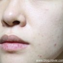 블라썸스킨케어