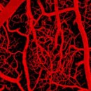 새론메디 이미지