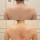 씨앤씨 피부관리