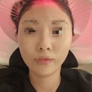헤드스파모하니