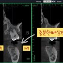 유천플란트치과 이미지