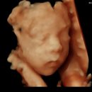 비타민엔젤스주 | 임신 26주~28주 기록 | 임신성 당뇨 검사, 3D 입체초음파, 임산부 치질(ㅠㅠ)