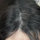 에르모사뷰티 두피문신아카데미 | [강남/역삼역 두피문신] 두피문신으로 가르마탈모 해결 ‘미작뷰티 강남 본점’ 리얼 후기