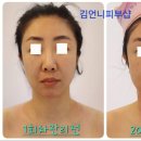 김언니피부샵
