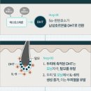 탈모 샴푸, 비엘모 스칼프 샴푸 - 두피와 모발을 건강하게