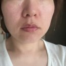 모던스킨 | AI 피부과_ 피부과 시술 뭐 받아야 할지 모르겠을 때 /쥬베룩스킨 후기