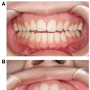 서울나란이치과교정과치과의원 | 수원교정치과 추천, 부정교합의 이해부터 시작입니다