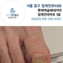 발톱문제 해결방법은? 컷팅까지 섬세하게 시원한 발관리! 발톱무좀 이렇게 해결해야해요 이미지