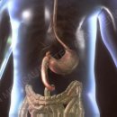 연부조직 전이[Soft tissue metastatic]종양혈액질환 이미지