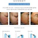 피에스엘 이미지