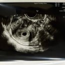 서울아가온여성의원 이미지