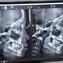 그랜드치과병원 | 어린이 부정교합 교정 | 원주그랜드치과 (내돈내치)