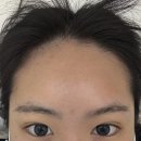 부천눈썹4U뷰티마스터 | 부천시청 왁싱 뷰티유이 부천시청점 시술경력 10년차 대표원장님께 헤어라인과 이마왁싱 후기