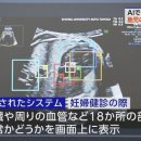 9월 24일 화-AI로 태아의 심장 이상 조기 발견 가능 이미지