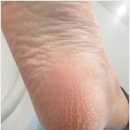 디바네일 이미지