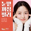 터치미의원 | 눈밑꺼짐필러후기 효과 다크서클 잘하는곳 1cc