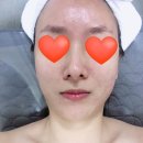 F8017 | 가든파이브 루라에스테틱 송파 피부관리 여드름피부케어 후기