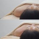 경북 경산 에스테틱 물오른피부 웨딩관리 찐 후기