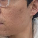 오월 | 중리동 피부관리 추천하는 피부샵, 오월에스테틱 후기