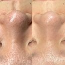 UR(의정부시)-[민락로]-상-86 | 의정부민락동피부관리 모공노화 전문에스테틱 루미나르뷰티