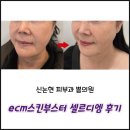건강한가족의원 | 신논현피부과 쁨의원 ecm스킨부스터 셀르디엠 후기 (효과, 통증, 비포에프터)
