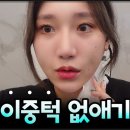 더디자인성형외과의원 | 상담실장이 직접 받아본 다움성형외과 김대현 원장 브이리프트 이중턱 수술후기