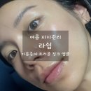 징크 | 여름 피지관리 고민 끝! 라쉼 기름종이 트러블 징크 앰플 후기